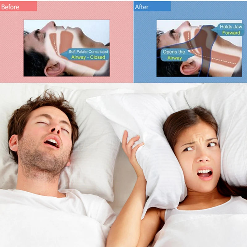 Adjustable Anti-Snoring Chin Strap for Sleep Apnea Relief – Comfortable Sleep Aid for Better Sleep Quality 4