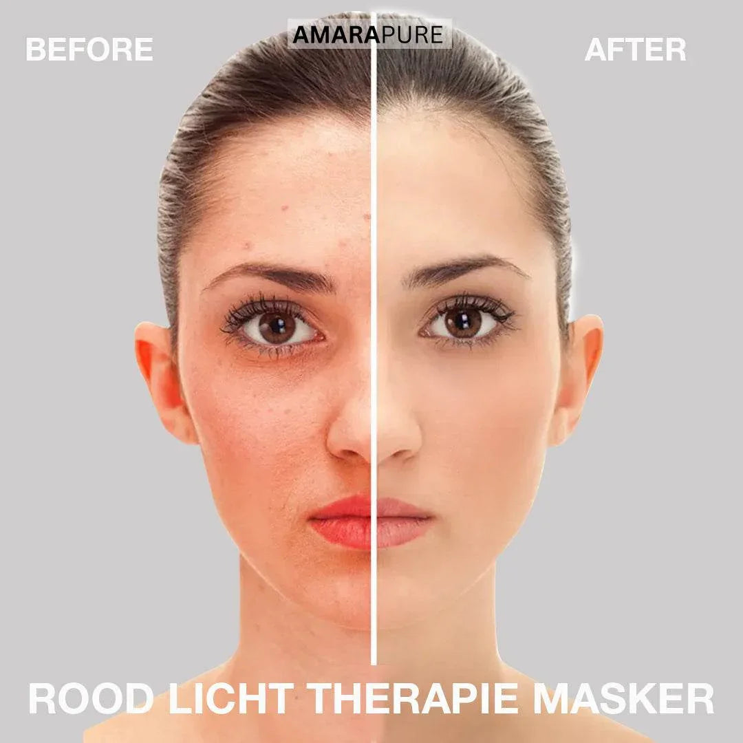 Face Mask for Red Light Therapy – 204 Diodes